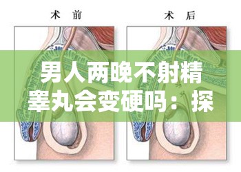 男人两晚不射精睾丸会变硬吗：探讨这一现象的原因及影响