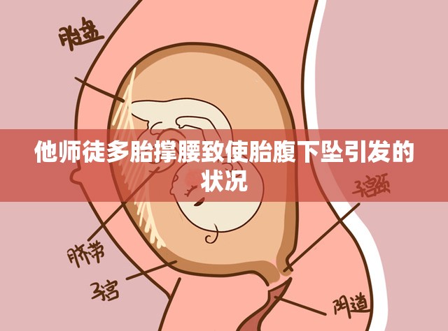 他师徒多胎撑腰致使胎腹下坠引发的状况