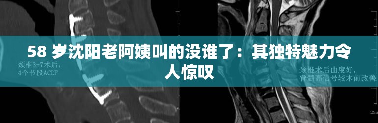 58 岁沈阳老阿姨叫的没谁了：其独特魅力令人惊叹