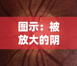 图示：被放大的阴脣肥大蝴蝶，这是怎么回事？